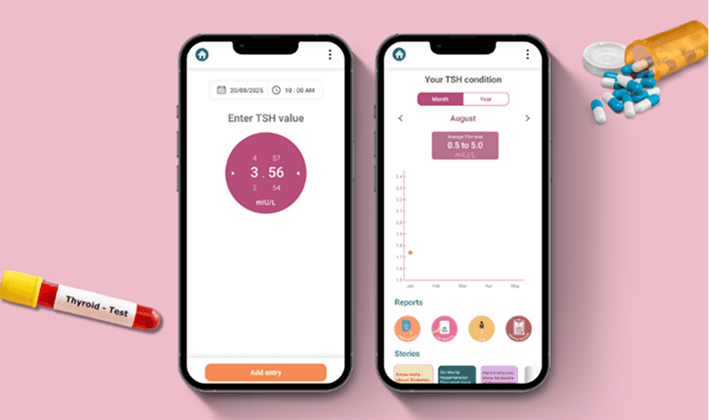 Trends that tell your story